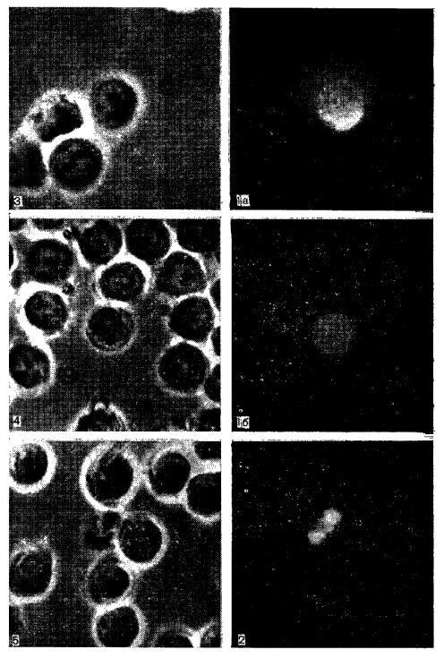 Типы (1—5) флюоресценции лимфоцитов человека