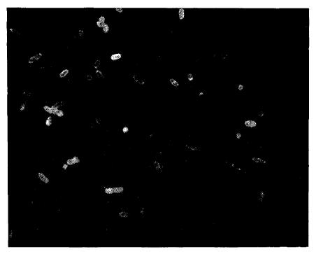 Выявление нагруженных антителами бактерий в моче (Е. coli) при помощи меченных ФИТЦ IgG против АГ человека