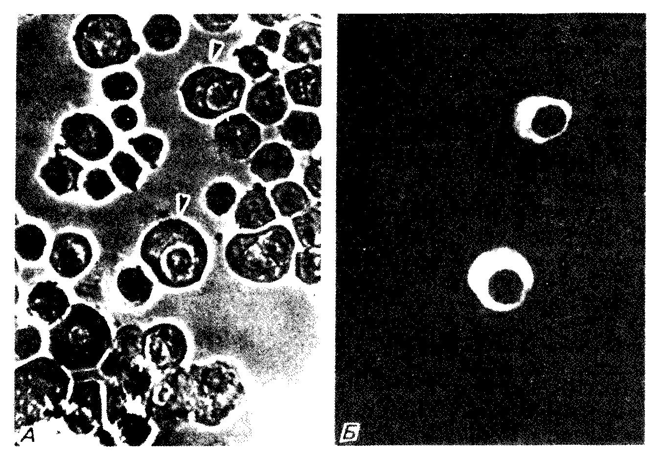 Микрофотография клеток костного мозга мыши, фиксированных и окрашенных козьими антителами к мышиному IgG<sub>2b</sub>, конъюгированными с родаминизотиоцианатом.