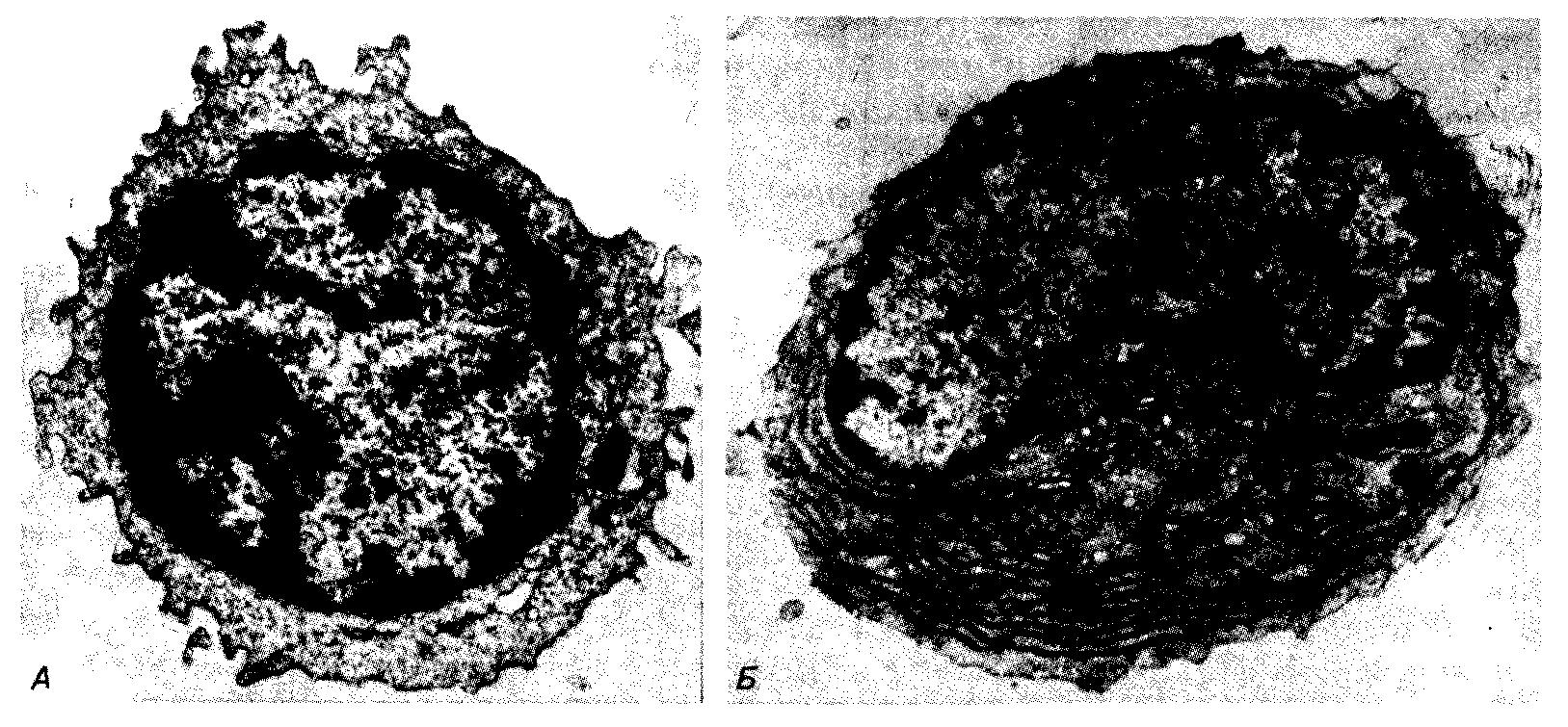 Электронные микрофотографии, иллюстрирующие различие ультраструктуры малого В-лимфоцита и незрелой плазматической клетки, выделенной из периферической крови человека.